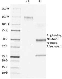 CD7 Antibody (C7/511), Novus Biologicals:Antibodies:Primary Antibodies